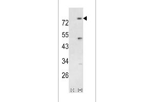 Western blot analysis of PIK3R5 using rabbit polyclonal PIK3R5 Antibody using 293 cell lysates (2 ug/lane) either nontransfected (Lane 1) or transiently transfected with the PIK3R5 gene (Lane 2). (PIK3R5 抗体  (AA 392-421))