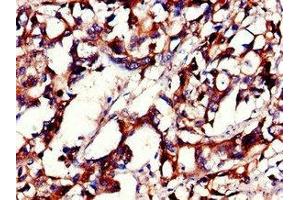 Immunohistochemistry (IHC) image for anti-Pleckstrin Homology-Like Domain, Family B, Member 2 (PHLDB2) (AA 734-1030) antibody (ABIN7163679)