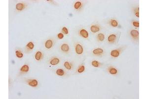 Immunocytochemistry analysis of ABIN7139155 diluted at 1:5 and staining in Hela cells (treated with 30mM sodium butyrate for 4h) performed on a Leica BondTM system. (Histone H2B 抗体  (acLys120))