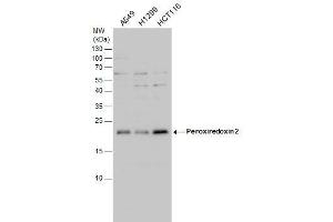 WB Image Peroxiredoxin 2 antibody detects Peroxiredoxin 2 protein by western blot analysis. (Peroxiredoxin 2 抗体)