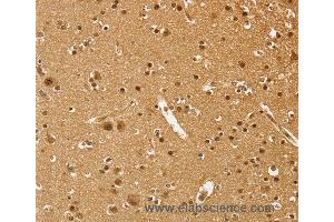 Immunohistochemistry of Human brain  using PSMC1 Polyclonal Antibody at dilution of 1:40 (PSMC1 抗体)