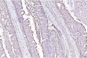 IHC analysis of PLP2 using anti-PLP2 antibody (ABIN7600320). (PLP2 抗体  (AA 18-152))