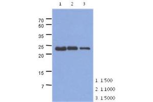 Image no. 1 for anti-Slow Skeletal Troponin I (TNNI1) (AA 1-187), (N-Term) antibody (ABIN1449413) (TNNI1 抗体  (N-Term))