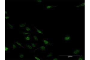 Immunofluorescence of purified MaxPab antibody to MSX2 on HeLa cell. (Msx2/Hox8 抗体  (AA 1-267))