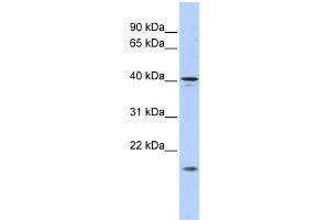 WB Suggested Anti-SLAIN1 Antibody Titration: 0. (SLAIN1 抗体  (Middle Region))