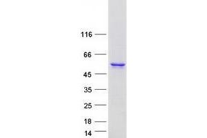 Validation with Western Blot (CYP26C1 Protein (Myc-DYKDDDDK Tag))