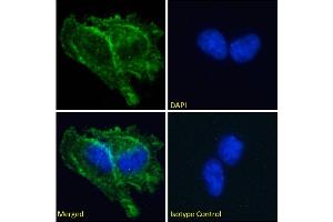 Immunofluorescence staining of fixed U251 cells with anti-Prion antibody 3F4. (Recombinant PRNP 抗体)