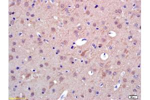 Formalin-fixed and paraffin embedded rat brain labeled with Anti-PAPOA Polyclonal Antibody, Unconjugated (ABIN1714857) at 1:200 followed by conjugation to the secondary antibody and DAB staining. (PAPOLA 抗体  (AA 601-700))