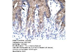 Rabbit Anti-NR4A1 Antibody  Paraffin Embedded Tissue: Human Stomach Cellular Data: Mucous Cells Antibody Concentration: 4. (NR4A1 抗体  (N-Term))