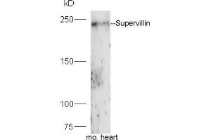 Mouse heart lysates probed with Rabbit Anti-Supervillin Polyclonal Antibody, Unconjugated (ABIN1714235) at 1:300 overnight at 4 °C. (Supervillin 抗体  (AA 51-150))
