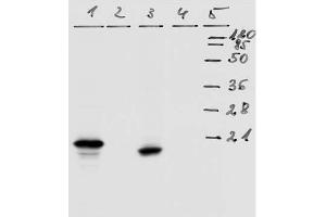 Western-Blot analysis of HPV-18 E7 protein. (HPV18 E7 抗体  (AA 36-70))