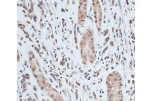 Immunohistochemistry (Paraffin-embedded Sections) (IHC (p)) image for anti-Zinc Finger Protein 416 (ZNF416) antibody (ABIN7258204)
