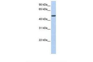 Image no. 1 for anti-Pleckstrin Homology-Like Domain, Family A, Member 1 (PHLDA1) (AA 218-267) antibody (ABIN6739002)