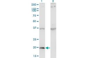 Western Blot analysis of IFNA1 expression in transfected 293T cell line by IFNA1 monoclonal antibody (M07), clone 3C6. (IFNA1 抗体  (AA 24-133))