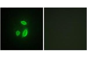 Immunofluorescence (IF) image for anti-Extra Spindle Poles Like 1 (ESPL1) (AA 767-816) antibody (ABIN2879105) (Separase 抗体  (AA 767-816))