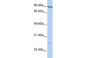 WB Suggested Anti-MARCH2 Antibody Titration:  0. (MARCH2 抗体  (C-Term))