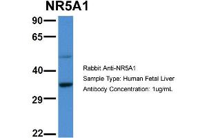 Western Blotting (WB) image for anti-Nuclear Receptor Subfamily 5, Group A, Member 1 (NR5A1) (Middle Region) antibody (ABIN2777447)