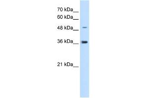 WB Suggested Anti-IRX1 Antibody Titration:  5. (IRX1 抗体  (N-Term))