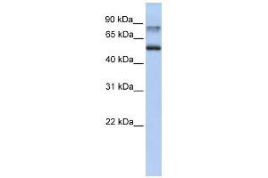 Epsin 1 antibody used at 1 ug/ml to detect target protein. (Epsin 1 抗体  (C-Term))