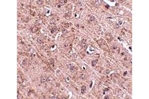 Immunohistochemistry (IHC) image for anti-GLE1 RNA Export Mediator (GLE1) (Middle Region) antibody (ABIN1030940) (GLE1 抗体  (Middle Region))