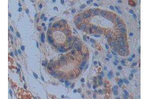 Immunohistochemistry (IHC) image for anti-Basigin (Ok Blood Group) (BSG) (AA 87-323) antibody (ABIN7441883)