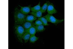 IF analysis of Acid Phosphatase/ACP5 using anti-Acid Phosphatase/ACP5 antibody (ABIN7601574).