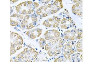 Immunohistochemistry of paraffin-embedded Human stomach using TNFRSF10A Polyclonal Antibody at dilution of 1:100 (40x lens). (TNFRSF10A 抗体)