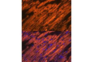 Immunofluorescence analysis of rat heart using HSP20/HSPB6 Rabbit mAb (ABIN7267592) at dilution of 1:100 (40x lens). (HSPB6 抗体)