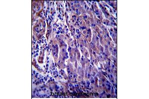 Immunohistochemistry (Paraffin-embedded Sections) (IHC (p)) image for anti-Cyclin-Dependent Kinase Inhibitor 1A (p21, Cip1) (CDKN1A) (AA 117-146), (C-Term) antibody (ABIN657391)