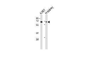 All lanes : Anti-Arylsulfatase D Antibody at 1:1000 dilution Lane 1: K562 whole cell lysates Lane 2: human kidney lysates Lysates/proteins at 20 μg per lane. (Arylsulfatase D 抗体)