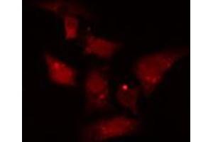 ABIN6277056 staining  SW626 cells by IF/ICC.