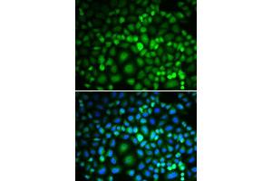 Immunofluorescence analysis of MCF-7 cells using RUVBL2 antibody. (RUVBL2 抗体  (AA 1-463))