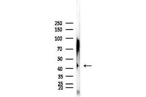 anti-1-Acylglycerol-3-Phosphate O-Acyltransferase 5 (Lysophosphatidic Acid Acyltransferase, Epsilon) (AGPAT5) (Internal Region) antibody