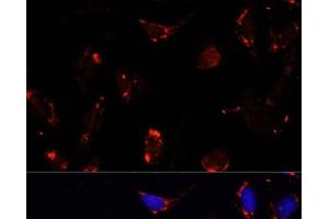 Immunofluorescence analysis of U-2 OS cells using TBRG4 Polyclonal Antibody at dilution of 1:100. (TBRG4 抗体)