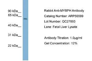 WB Suggested Anti-MYBPH  Antibody Titration: 0. (MYBPH 抗体  (Middle Region))