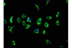 Immunofluorescence staining of A549 cells with ABIN7147051 at 1:133, counter-stained with DAPI. (ATP13A2 抗体  (AA 582-736))
