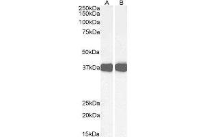 ABIN190828 (0. (Liver Arginase 抗体  (C-Term))
