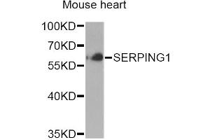 Western blot analysis of extracts of mouse heart, using SERPING1 Antibody (ABIN6290125) at 1:1000 dilution. (SERPING1 抗体)