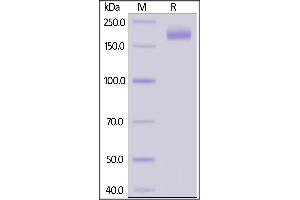SARS-CoV-2 S protein (D614G), His Tag, Super stable trimer on SDS-PAGE under reducing (R) condition.