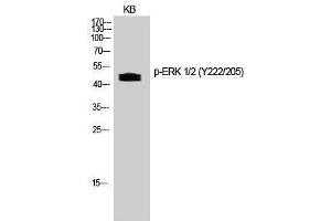 Western Blotting (WB) image for anti-Mitogen-Activated Protein Kinase 1/3 (MAPK1/3) (pTyr205), (pTyr222) antibody (ABIN3173143) (ERK1/2 抗体  (pTyr205, pTyr222))