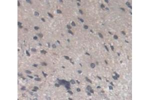 IHC-P analysis of Kidney tissue, with DAB staining. (Recoverin 抗体  (AA 2-200))