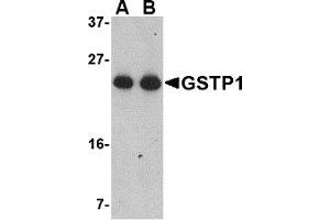 Western Blotting (WB) image for anti-Glutathione S-Transferase pi 1 (GSTP1) (Middle Region) antibody (ABIN1030946) (GSTP1 抗体  (Middle Region))