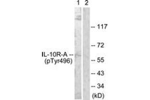 Western blot analysis of extracts from HuvEc cells, using IL-10R alpha (Phospho-Tyr496) Antibody. (IL-10RA 抗体  (pTyr496))