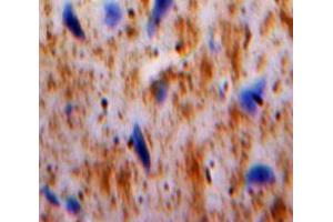 Used in DAB staining on fromalin fixed paraffin-embedded Brain tissue (PLAUR 抗体  (AA 123-216))