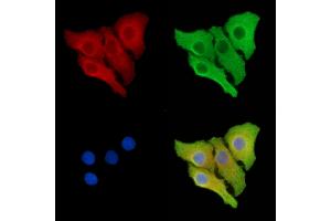 ABIN6264421 and ABIN6278673 staining Hela cells by IF/ICC. (PRKAB2 抗体  (N-Term))