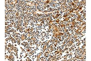 The image on the left is immunohistochemistry of paraffin-embedded Human tonsil tissue using ABIN7128894(CEACAM21 Antibody) at dilution 1/60, on the right is treated with fusion protein. (CEACAM21 抗体)