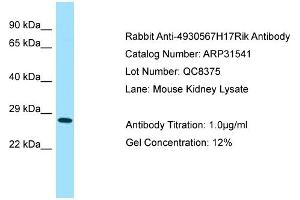 WB Suggested Anti-4930567H17Rik Antibody   Titration: 1. (4930567H17Rik 抗体  (Middle Region))