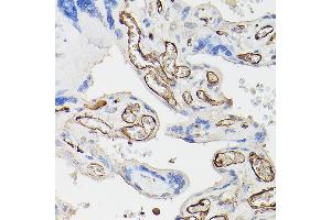 Immunohistochemistry of paraffin-embedded human placenta using CD34 Rabbit pAb (ABIN6134661, ABIN6138169, ABIN6138171 and ABIN6218103) at dilution of 1:100 (40x lens).
