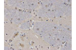 Immunohistochemistry (IHC) image for anti-Calcium/calmodulin-Dependent serine Protein Kinase (MAGUK Family) (CASK) antibody (ABIN1871447) (CASK 抗体)
