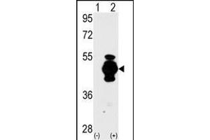 Western blot analysis of GF (arrow) using GF Antibody (N-term) 2017a. (GFAP 抗体  (N-Term))